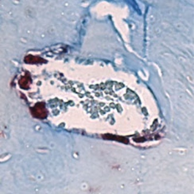 Gut bacteria trigger loss of tooth-supporting bone in mice