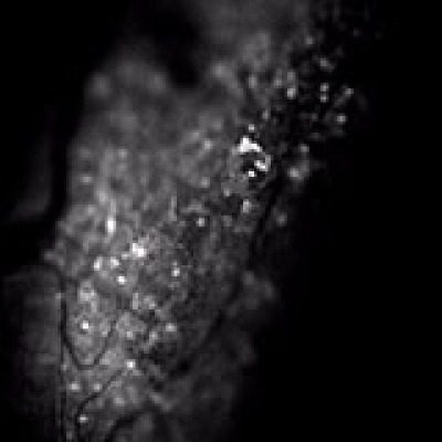 By visualizing pain signals in facial nerves, NIDCR researchers found that blocking a protein blunted pain signaling in mice, offering insight into safer pain relief.